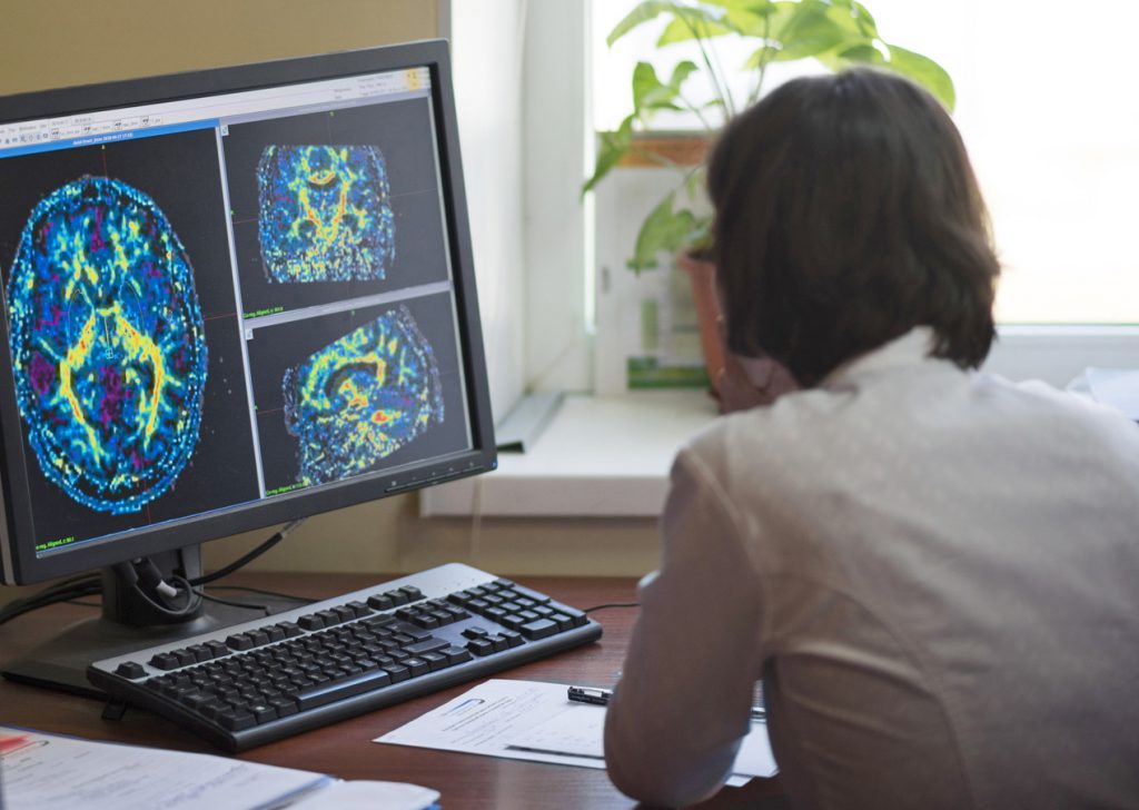 A radiologist is working on a CT scan of a brain tumor