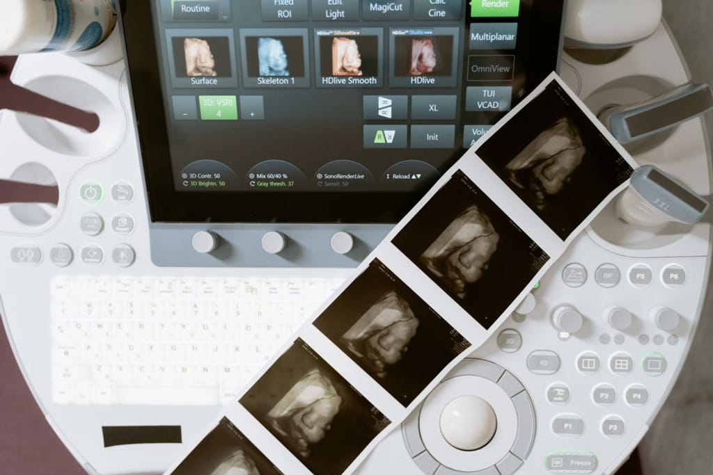 surrogacy tech